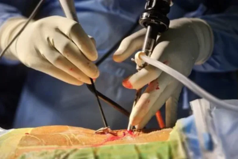 Endoscopic spine surgery
